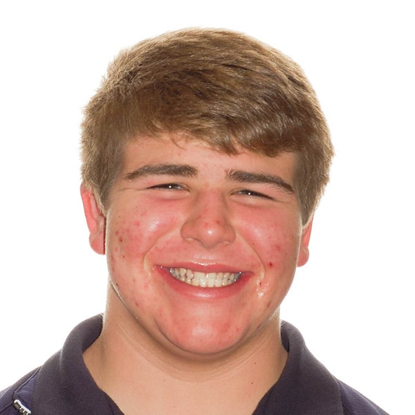 PDOC Before After-12